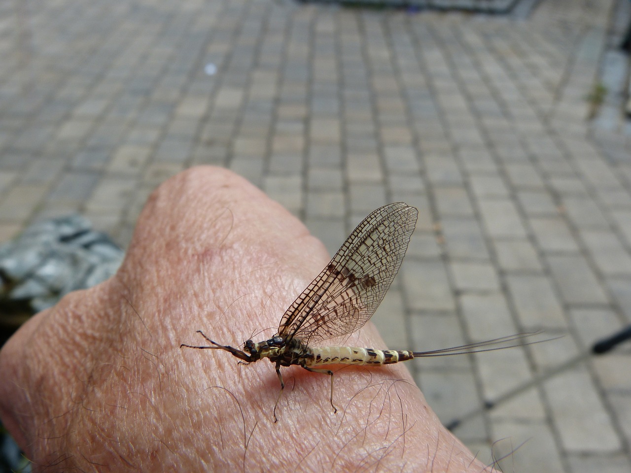 복부 성형가격